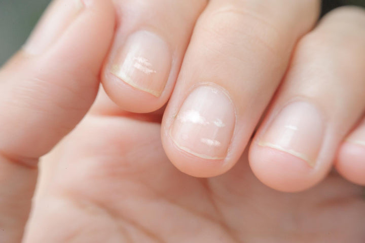 Symptoms of iron deficiency